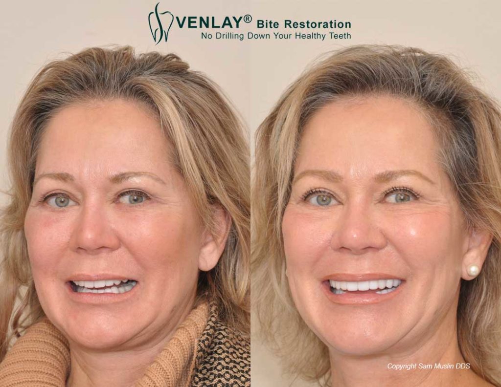 The Dental Facelift® Sam Muslin DDS